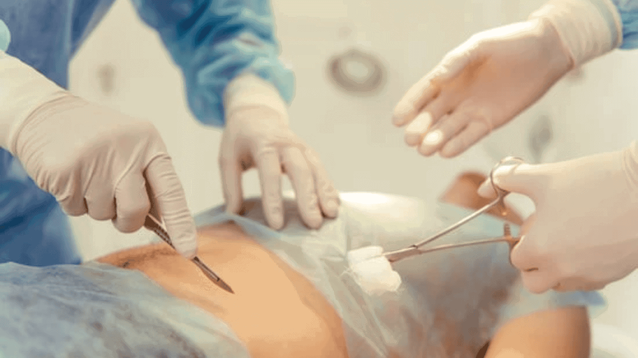 Apandisit Nedir? Belirtileri Nelerdir?