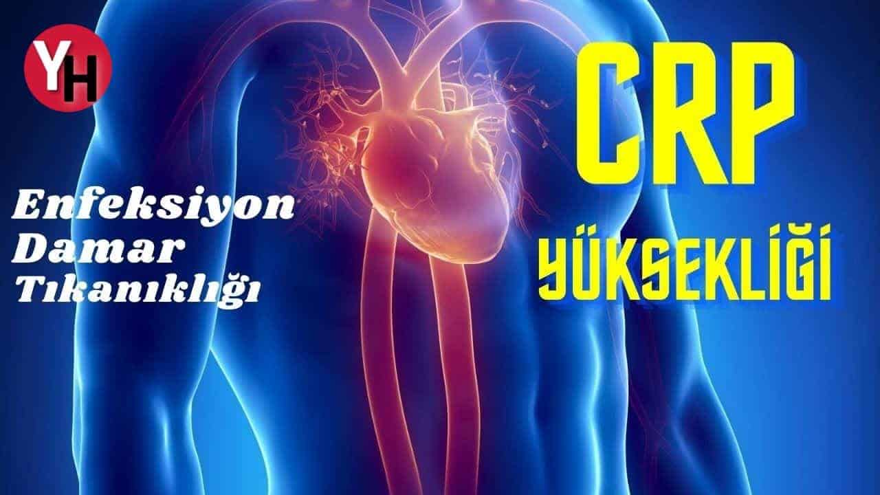 crp-yuksekligi-nedenleri-belirtileri-ve-tedavisi.jpg