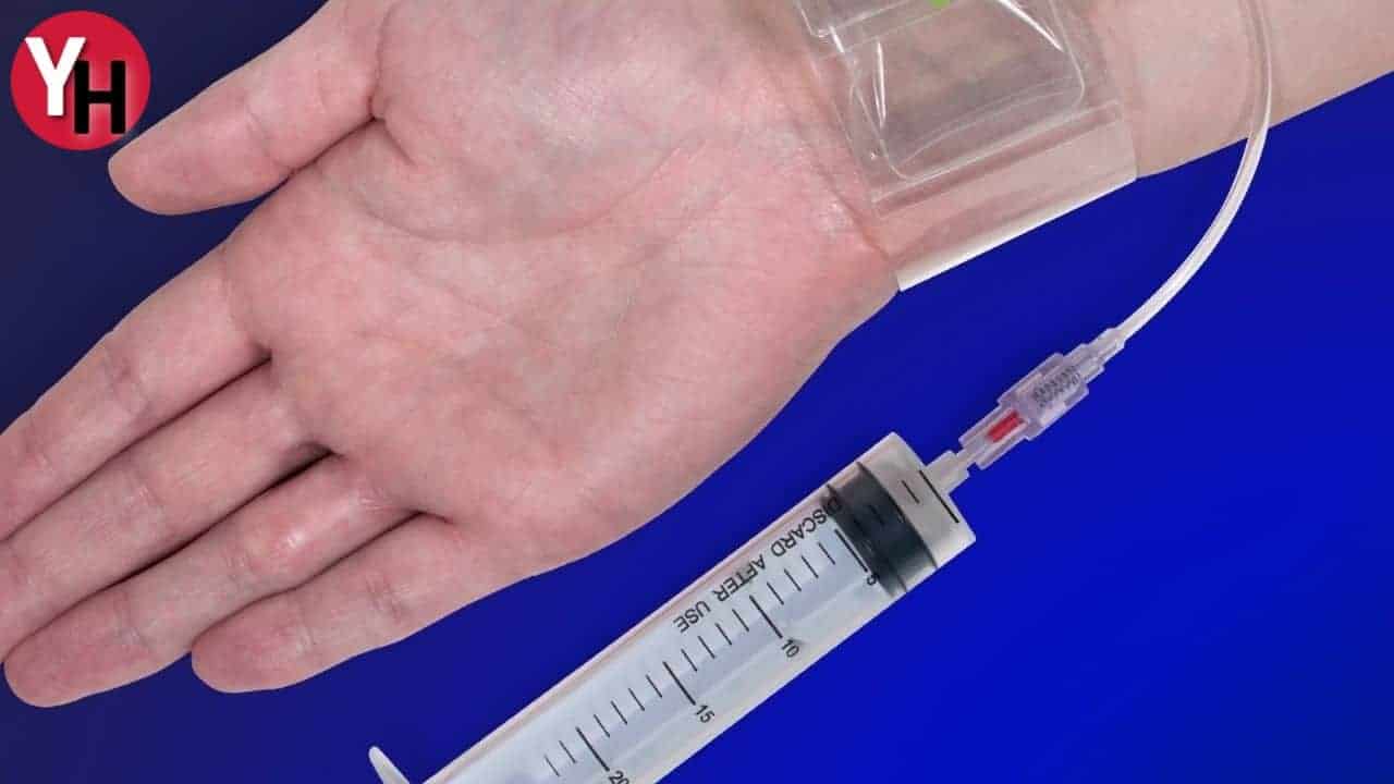 El Bileğinden Anjiyo Nasıl Yapılır?