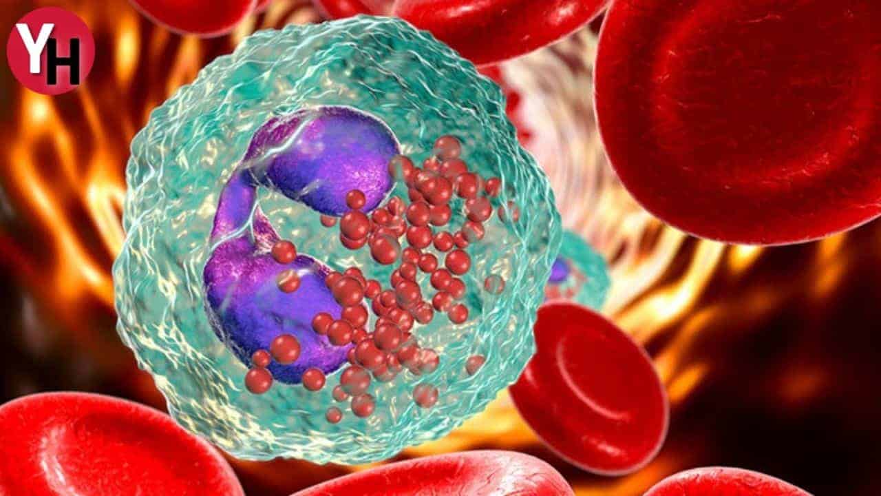 Eozinofil Yüksekliği ve Düşüklüğü: Belirtileri ve Tedavi Yöntemleri