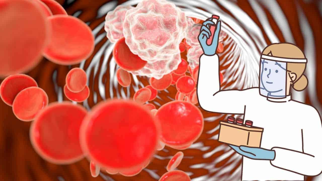 Kanda Enfeksiyonları: Belirtiler, Tanı ve Tedavi
