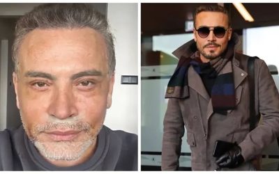 Cenk Eren, Estetik Ameliyatını Neden Yaptığını Açıkladı