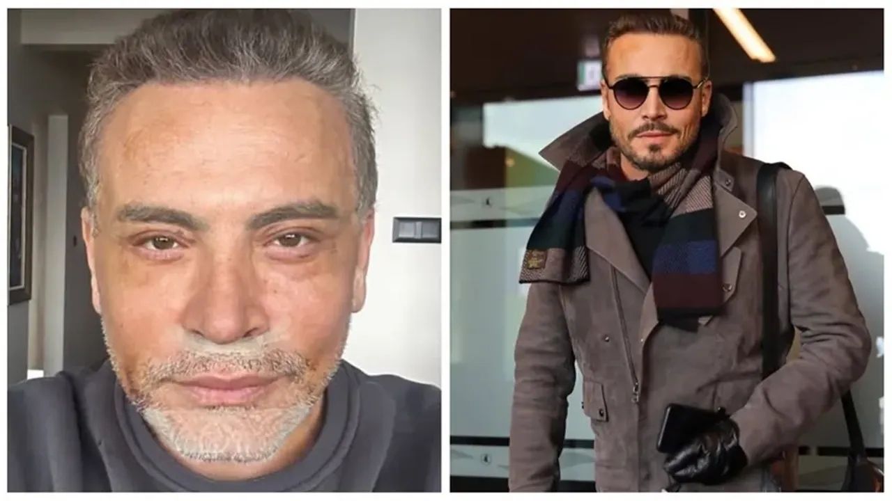 cenk eren, estetik ameliyatını neden yaptığını açıkladı