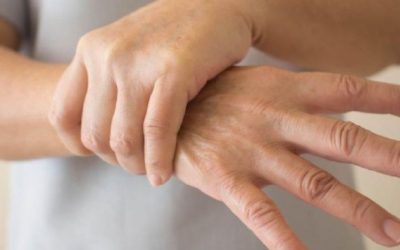 Elde Uyuşma: Nedir, Nasıl Tedavi Edilir ve Belirtileri Nelerdir?