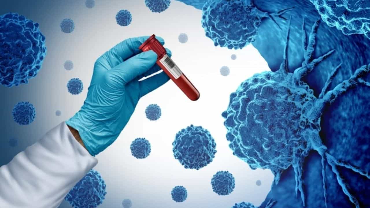 Kanserin Erken Belirtileri ve Tedavi Yöntemleri Hakkında Her Şey