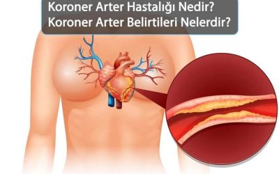 Koroner Arter Hastalığı (KAH) Nedir? Belirtileri, Nedenleri ve Tedavi Yöntemleri