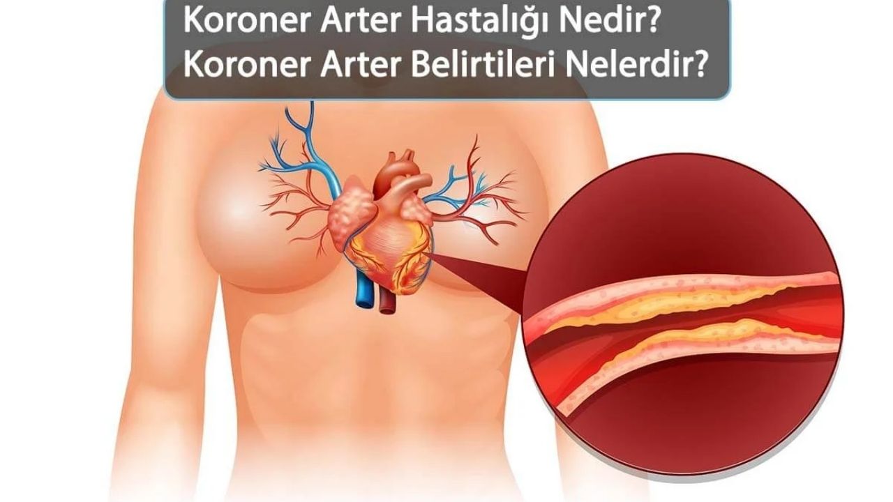 Koroner Arter Hastalığı (KAH) Nedir Belirtileri, Nedenleri ve Tedavi Yöntemleri