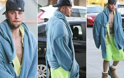 Justin Bieber’ın Üstsüz ve Dağınık Hali Hayranlarını Endişelendirdi