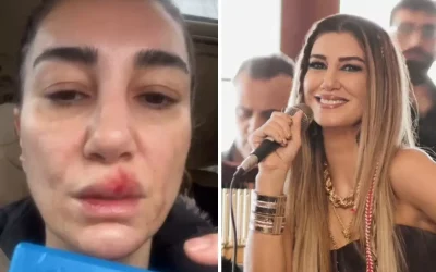 Temizlik Sırasında Talihsiz Kaza Sonucu Nadide Sultan Hastaneye Kaldırıldı
