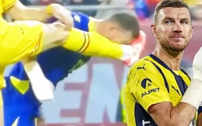 Dzeko’nun Burnu Kırıldı, Yüzü Korkunç!