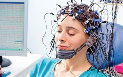 EEG (Elektroensefalografi): Beyin Aktivitesinin İzlenmesi ve Klinik Uygulamaları