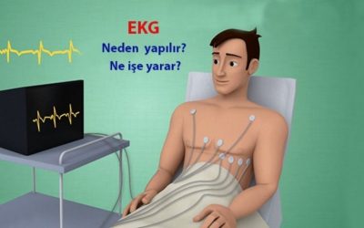 EKG (Elektrokardiyogram): Kalp Sağlığını Anlamada Kritik Bir Test