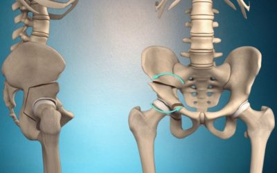 Kalça Çıkığı: Tanımı, Sebepleri, Belirtileri, Tedavi Yöntemleri ve Rehabilitasyon Süreci