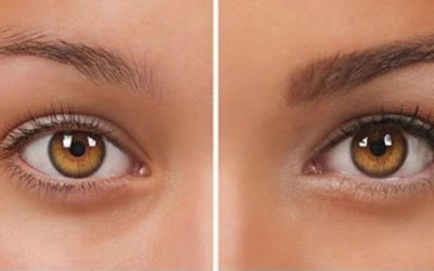 Kaş Çıkması İçin Beslenme Önerileri ve Vitaminler