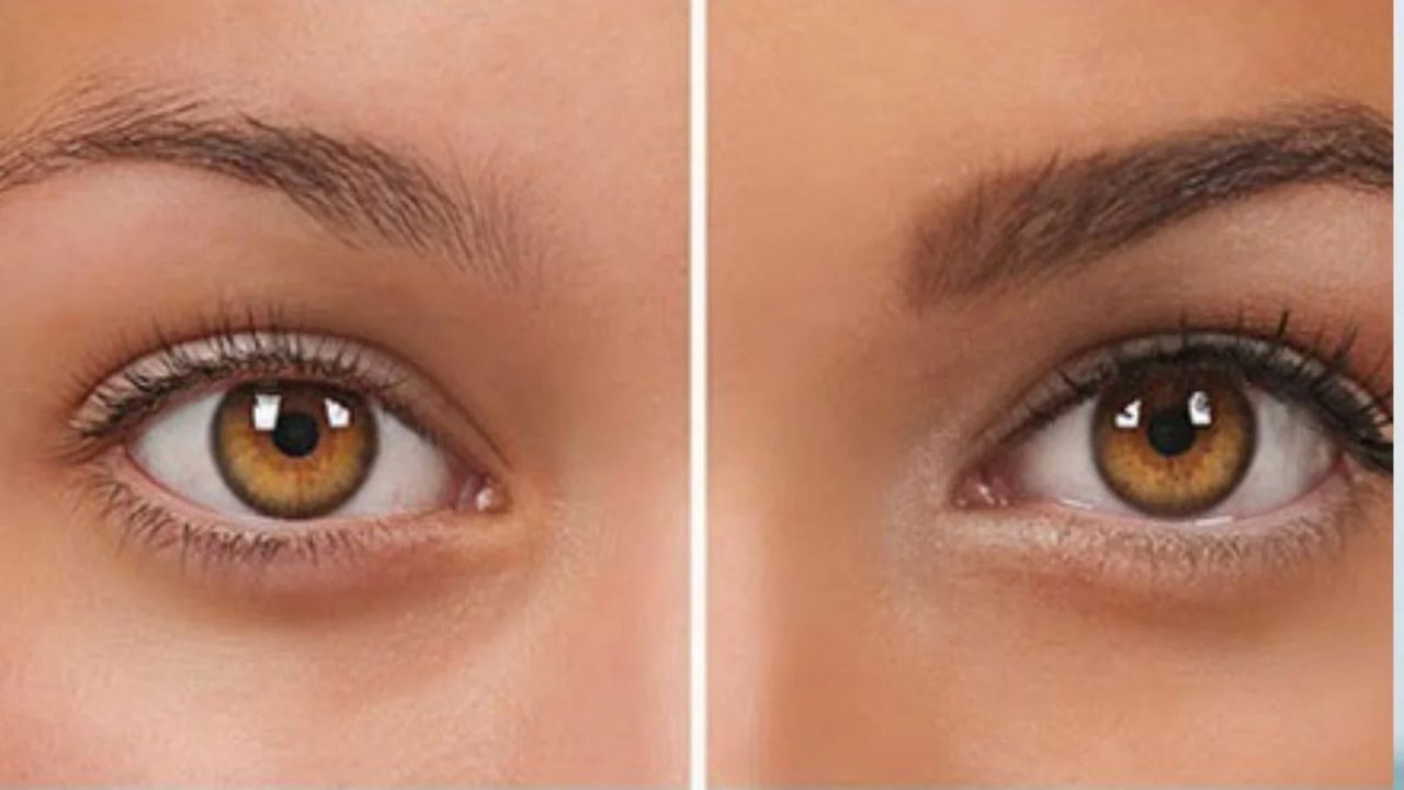 Kaş Çıkması İçin Beslenme Önerileri ve Vitaminler