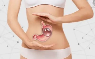 Mide Balonu Nedir? Zayıflamak İçin Nasıl Uygulanır?