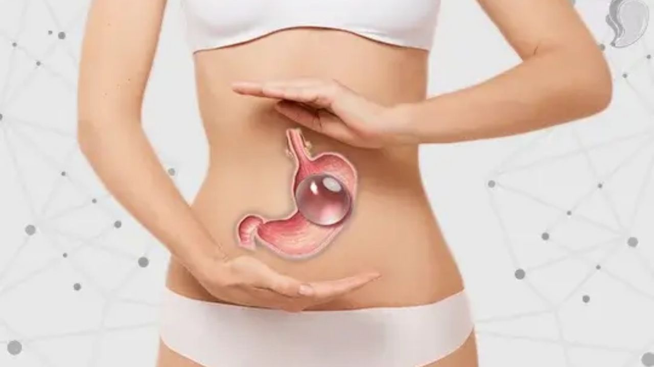 Mide Balonu Nedir Zayıflamak İçin Nasıl Uygulanır