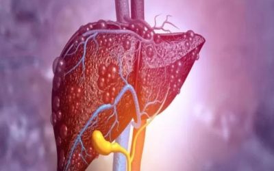 Spor ve Kas Yıkımı: Karaciğer Enzimlerini Yükseltir mi?