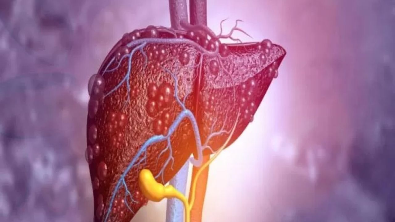Spor ve Kas Yıkımı Karaciğer Enzimlerini Yükseltir mi