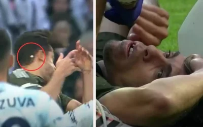 Beşiktaş’ta Ardarda Şanssızlıklar: 2 Sakatlık ve Bir Diş Kırılması!