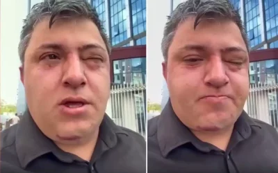 Altındağ Belediye Başkanı Tiryaki’nin işçiyi darp ettiği iddiası ortaya atıldı
