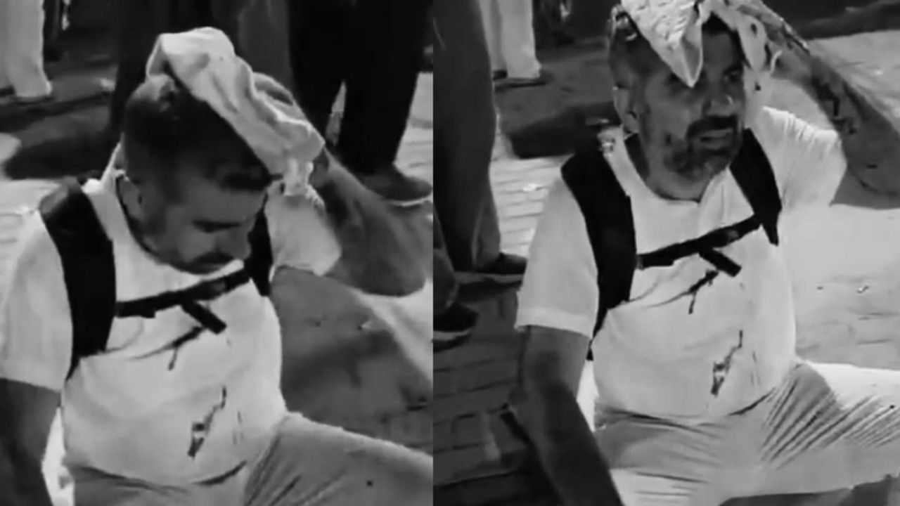 Mısır'da saldırıya uğrayan HÜDA PAR'lı Dinç'le röportaj