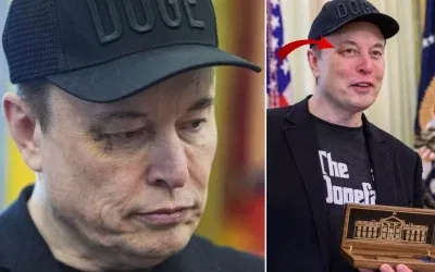 Elon Musk’ın gözündeki morluk hakkında şaşırtıcı iddia