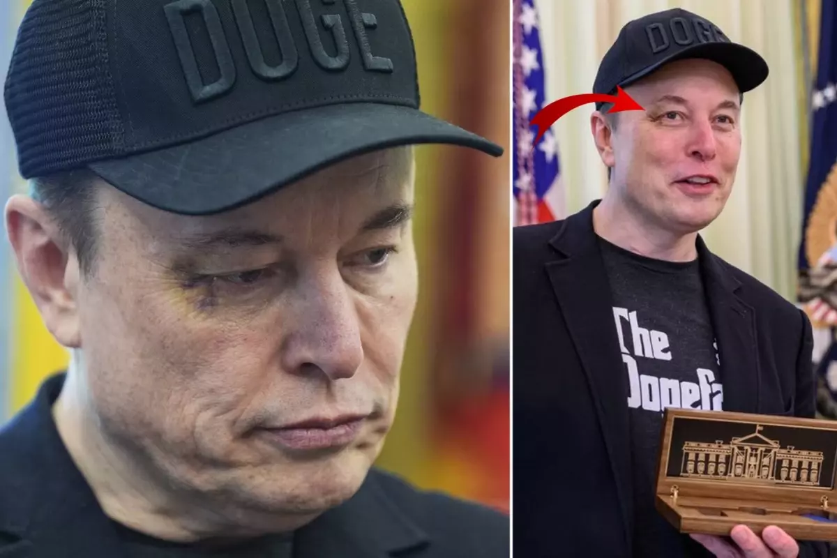 elon-musk-in-gozundeki-morlukla-ilgili-bomba-iddia-18696496_4566_amp.jpg