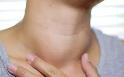 Boynunuzdaki Şişlikler: Nedenleri ve Ne Zaman Ciddiye Alınmalı?