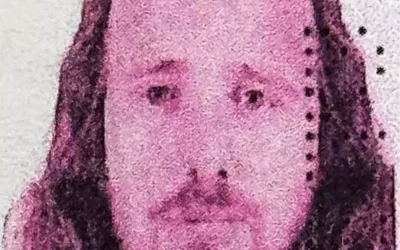 İstanbul’da Saç Ekimi Sonrası İngiliz Vatandaşının Ölümü